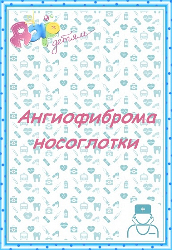 Ангиофиброма носоглотки
