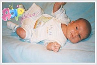 Атопический дерматит (детская экзема)